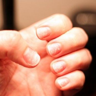 Need advice on how to deal with weak brittle nails. : r/RedditLaqueristas