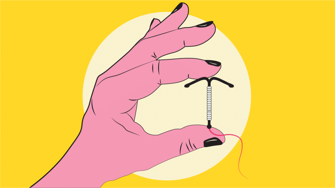 How to Check IUD Strings