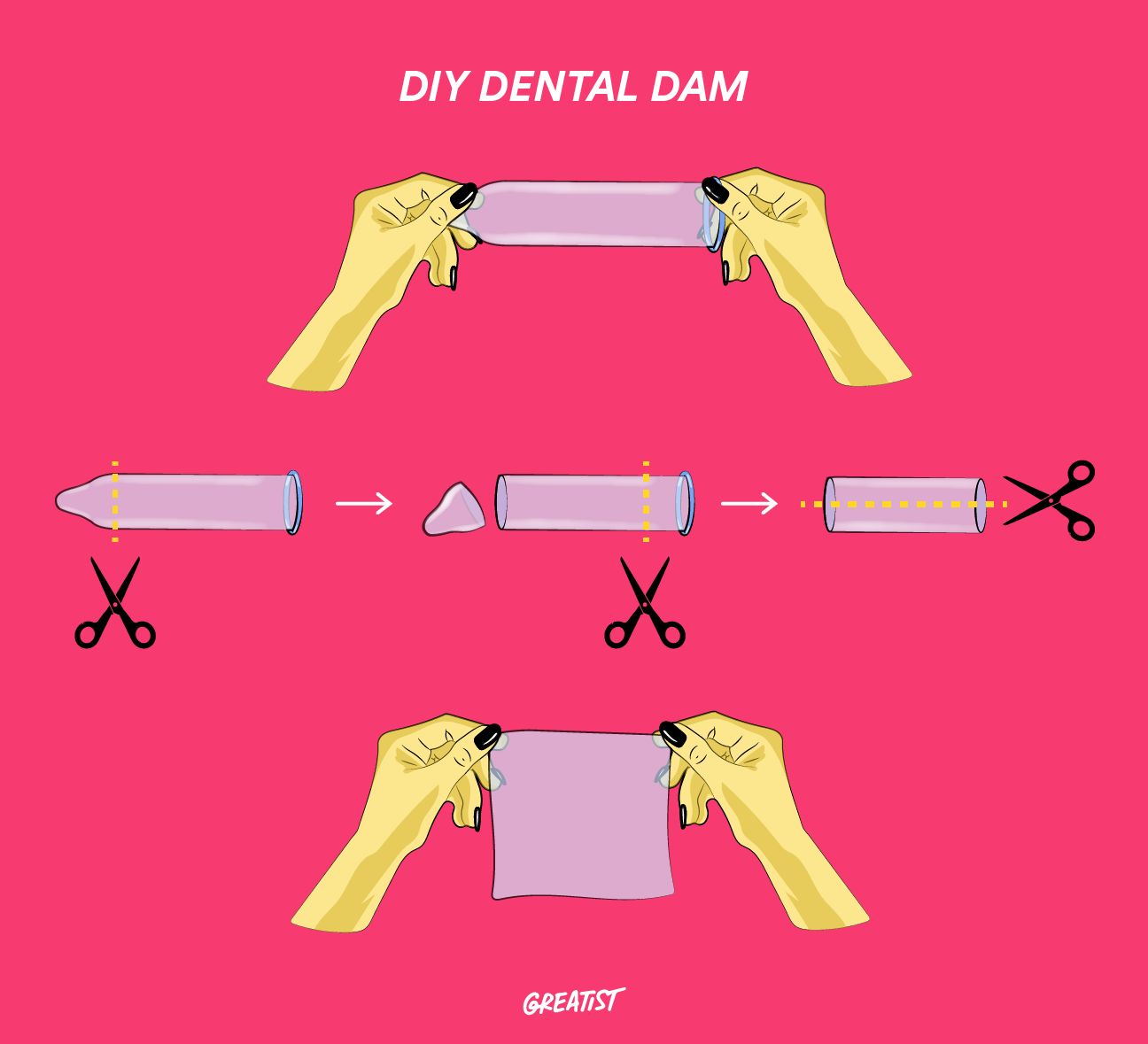 dental dam contraceptive in use