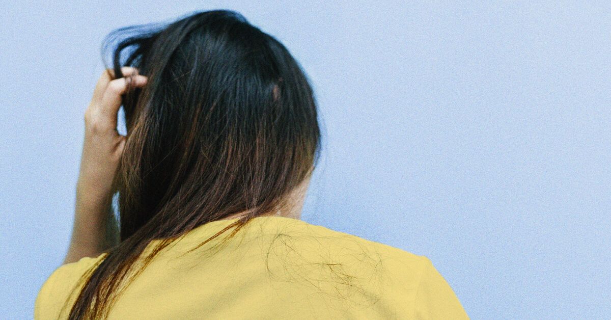 Scalp Psoriasis Symptoms, Causes, and Treatments Greatist