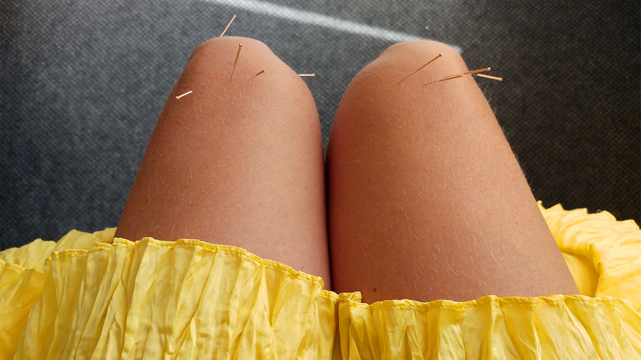 acupuncture for eczema