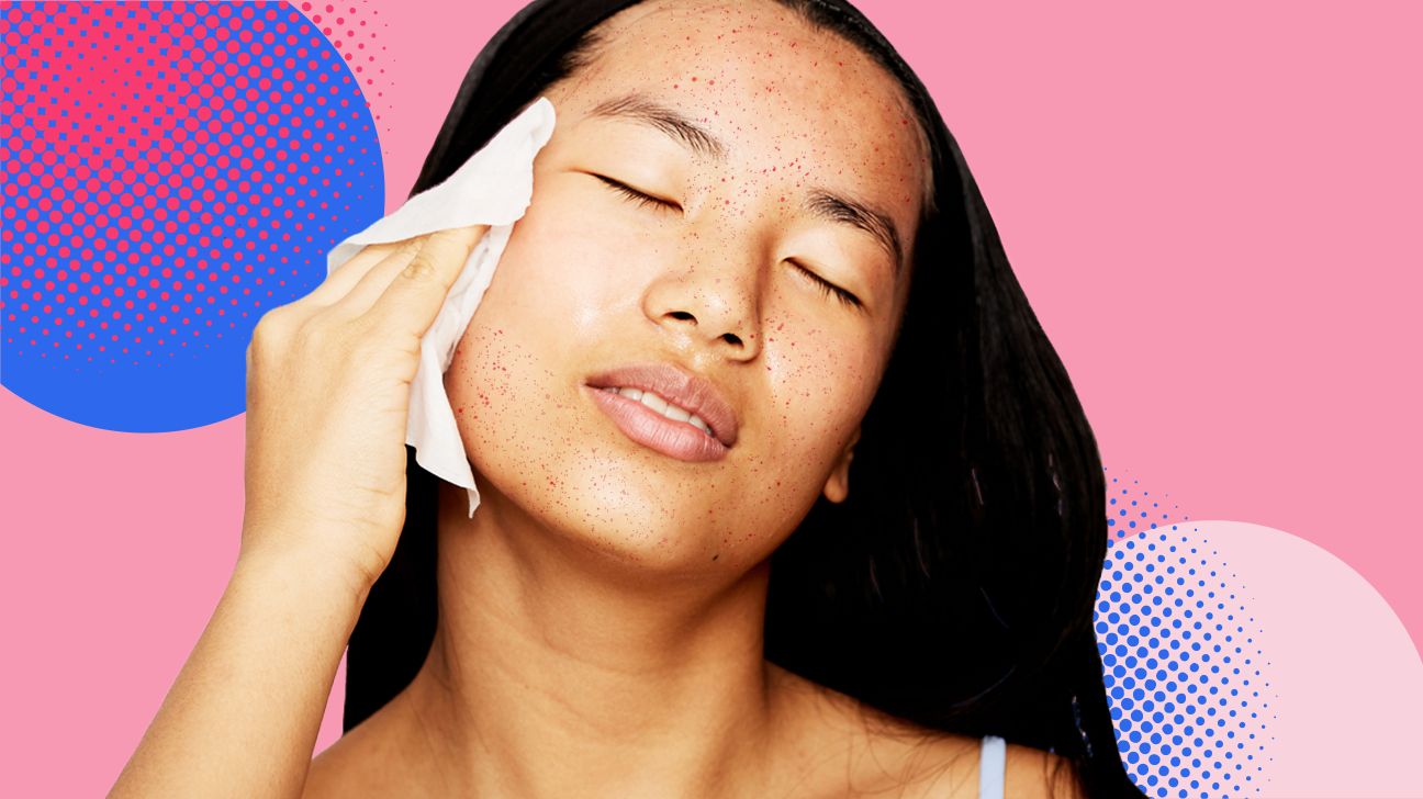 Woman wondering about All Types of Acne Scars