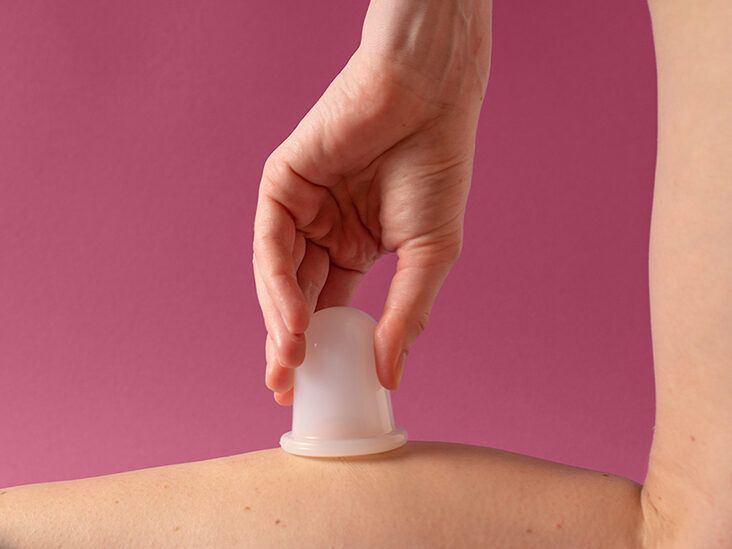 Cupping for Cellulite: Benefits, Side Effects, and How to Try It
