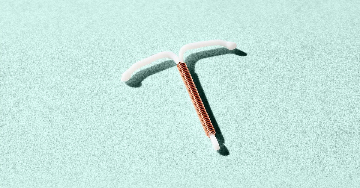 What You Need to Know About IUD Costs