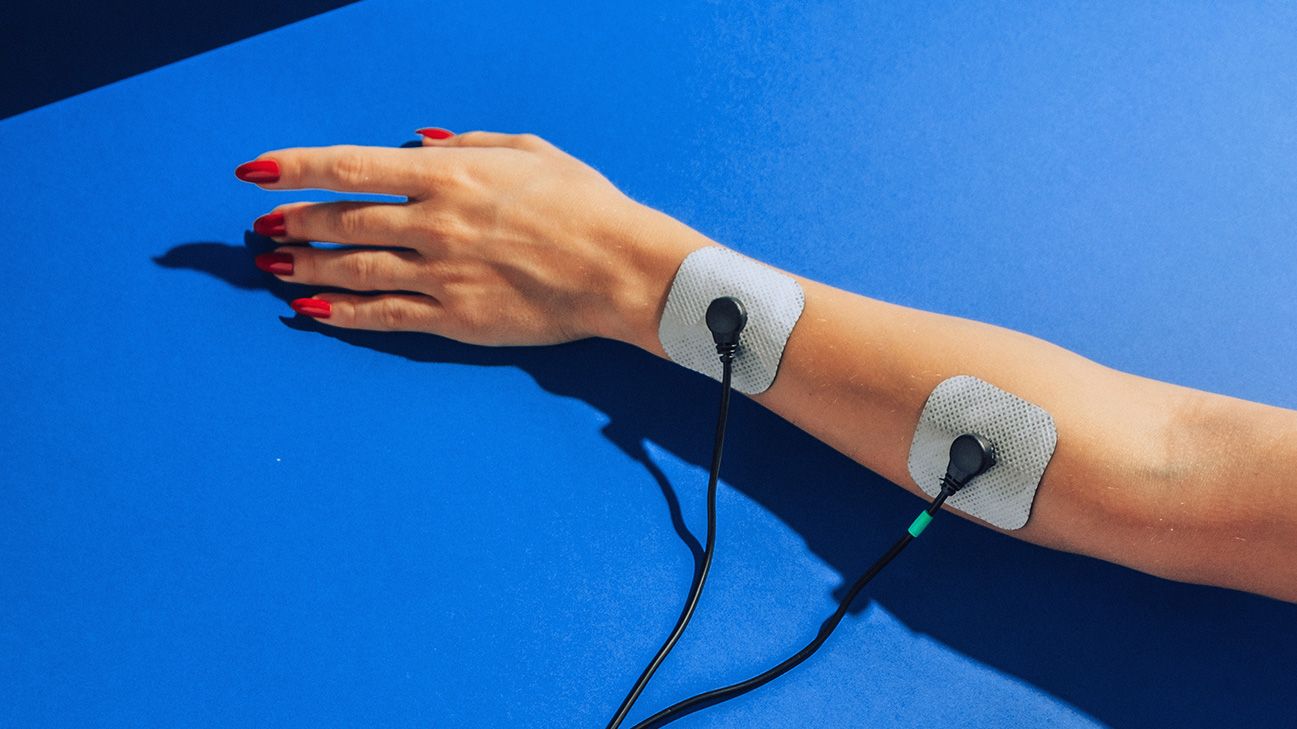 TENS (transcutaneous electrical nerve stimulation) - NHS