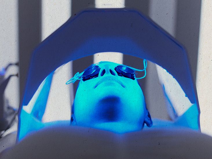 Blue light therapy for acne Benefits side effects and costs