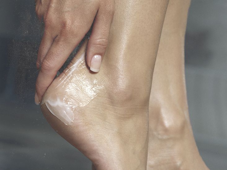 Cholestasis of pregnancy Symptoms, pictures, tests, diet, and more