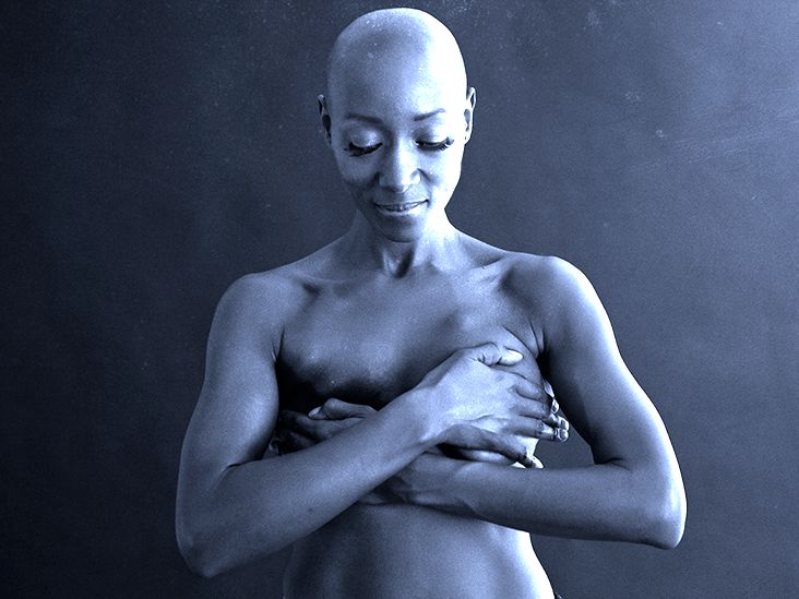 Dressed to Kill-Second Edition: The Link Between Breast Cancer and Bras