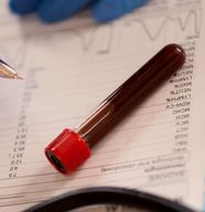 How Long Does It Take To Receive Blood Test Results A Guide