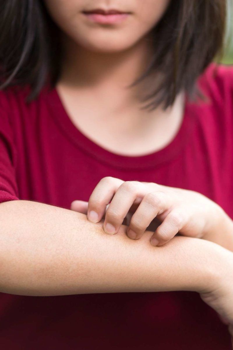 How long is ringworm contagious? What to know