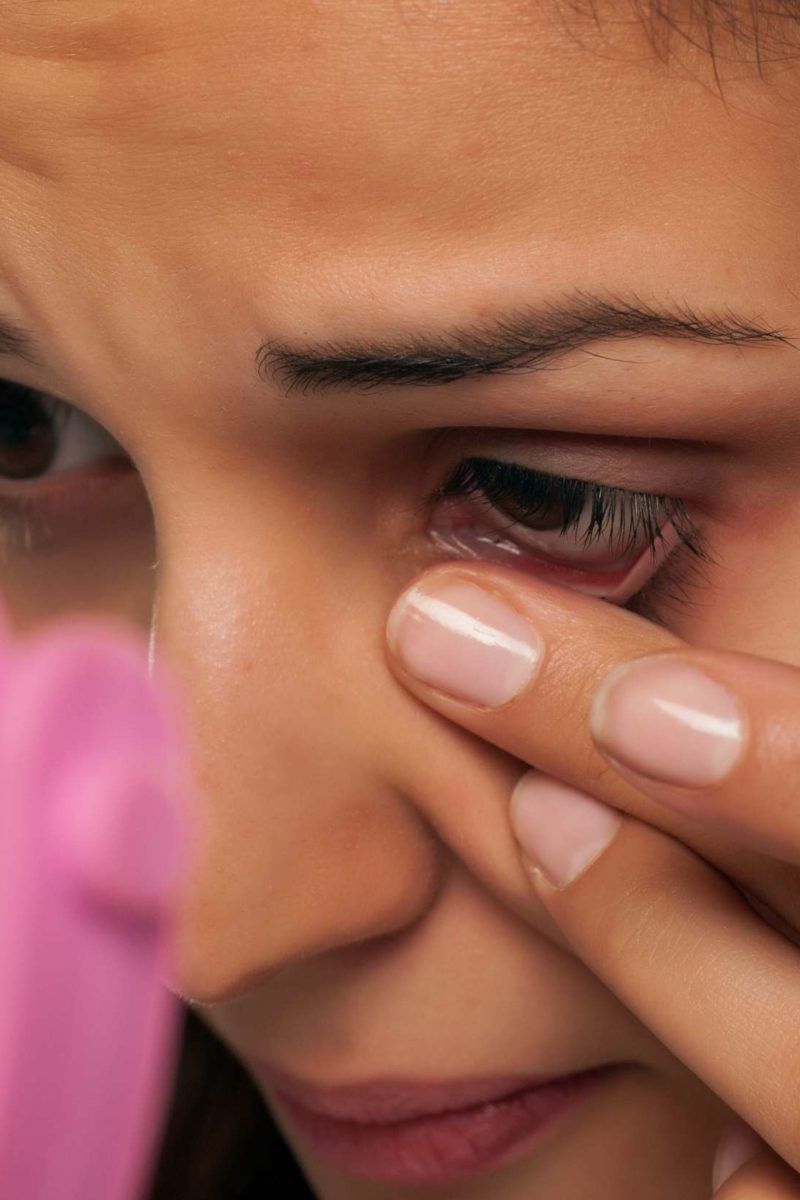 Skin tags on eyelids Causes and how to remove them
