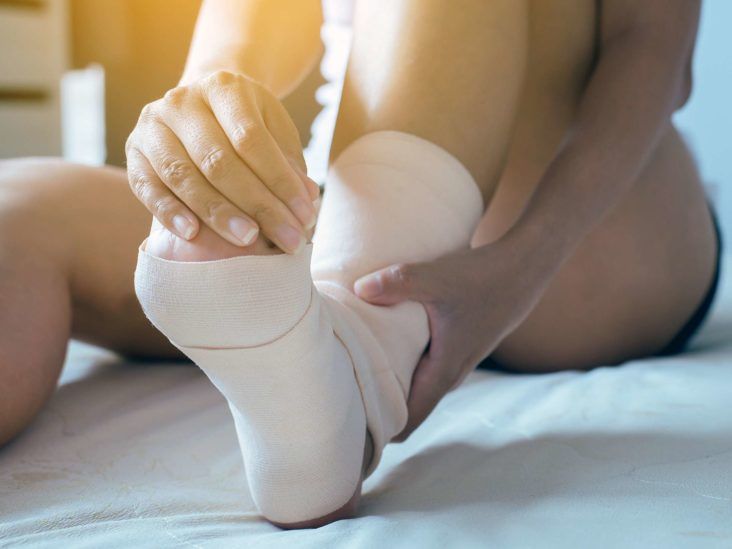 How to heal a sprained ankle: Tips for a fast recovery