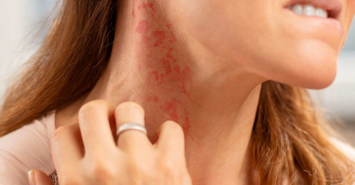 itchy-skin-rash-pictures-causes-symptoms-treatment-hubpages