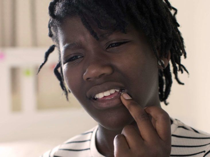 Stages of cold sore development: What to know