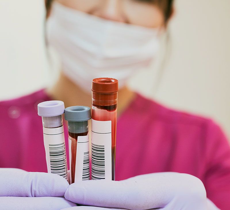 Blood tests: Types, routine testing, results, and more