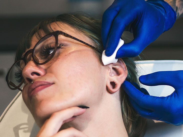 Tragus piercings for migraine Do they work?