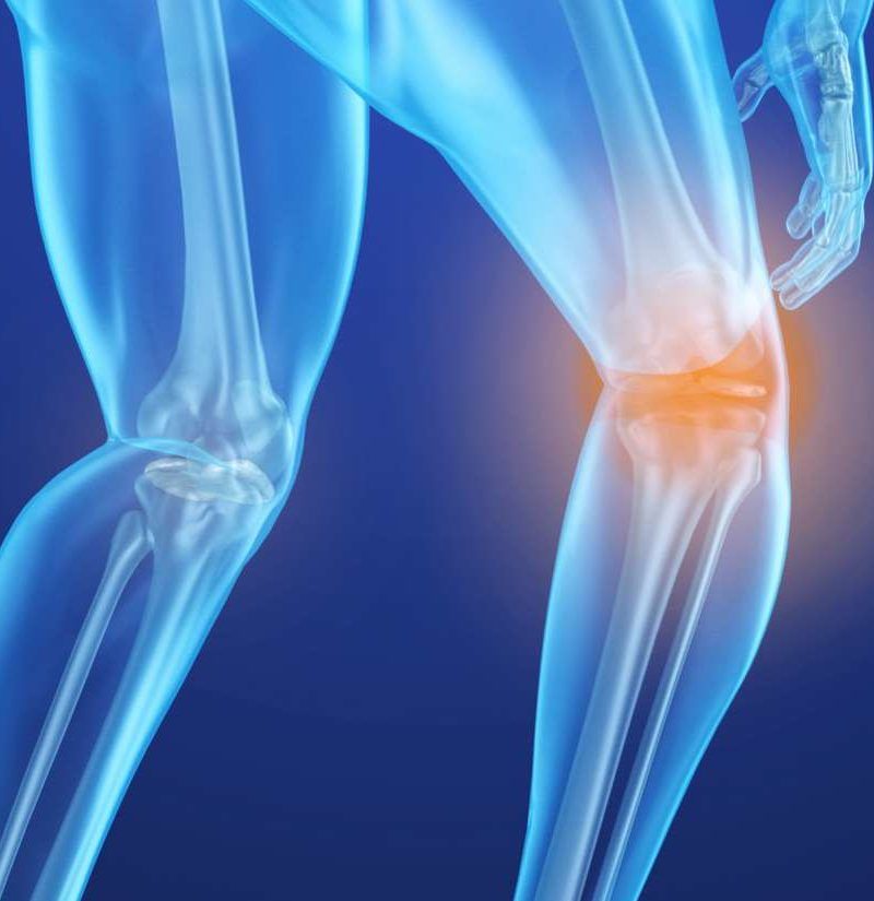 Osteoporosis: ACP update treatment guidelines for preventing bone fractures