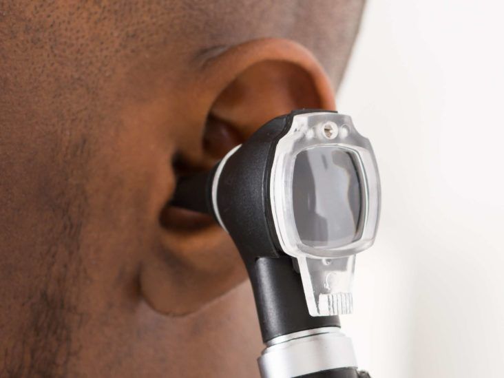 Hole in Ear: Symptoms, Causes, and Treatment of Preauricular Pits