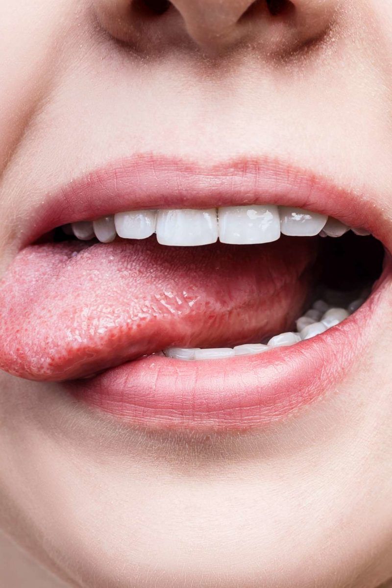 Sweet taste in mouth Causes and solutions