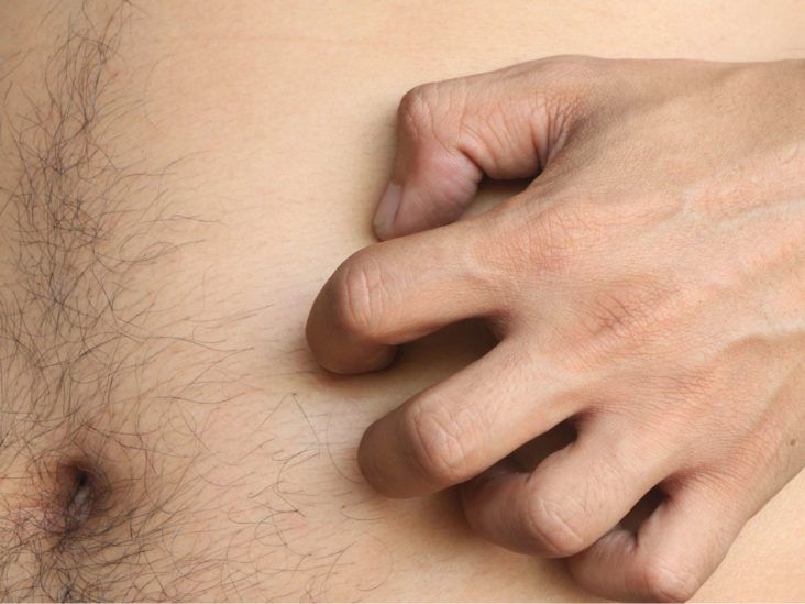Itchy breasts but no rash: 5 causes
