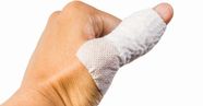 Sprained Thumb Treatment Recovery And Symptoms Sprained Thumb Treatment Recovery And Symptoms