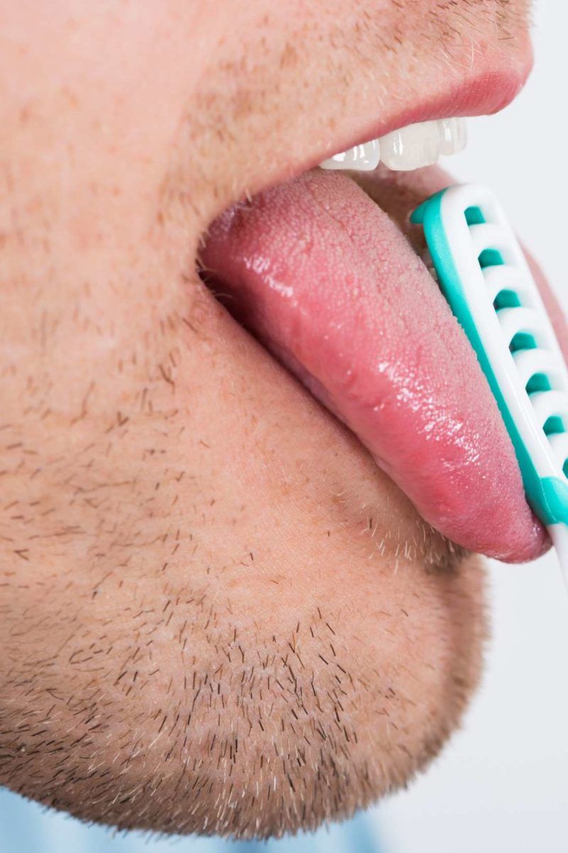Orange tongue: 4 causes and other colors