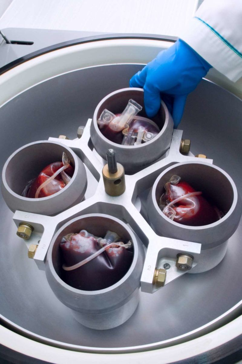 Plasmapheresis: Definition and what to expect, image size:800x1200