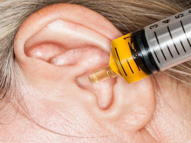 5 remedios naturales para limpiar tus oídos sin dañarlos - Mejor con Salud