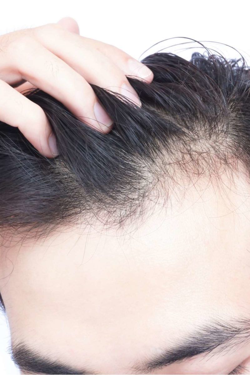 Hair and nail treatment – Skin Confidence Clinic