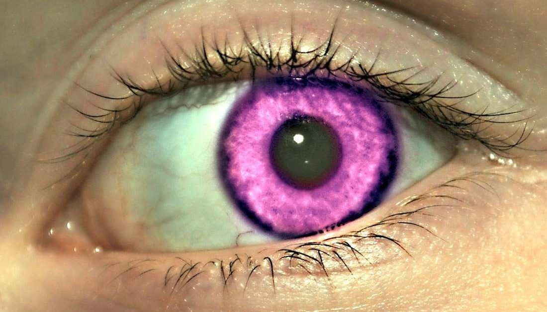 Does Eye Color Reveal Health Risks? - Vision Center