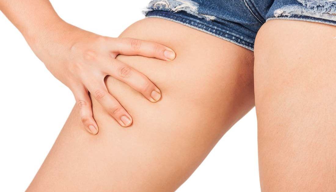 How to prevent chafing for your thighs, groin, armpits, and