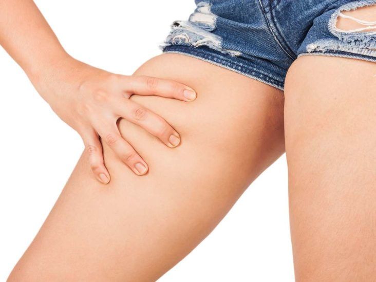 What causes chafing rash? Remedies, treatment, and prevention