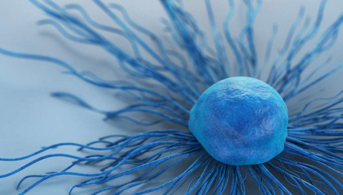 Vaginal bacteria may have a role in cervical cancer