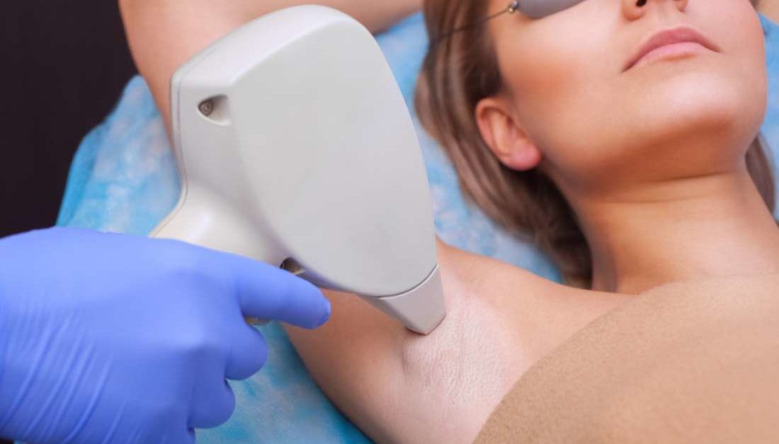 Hair Removal Laser