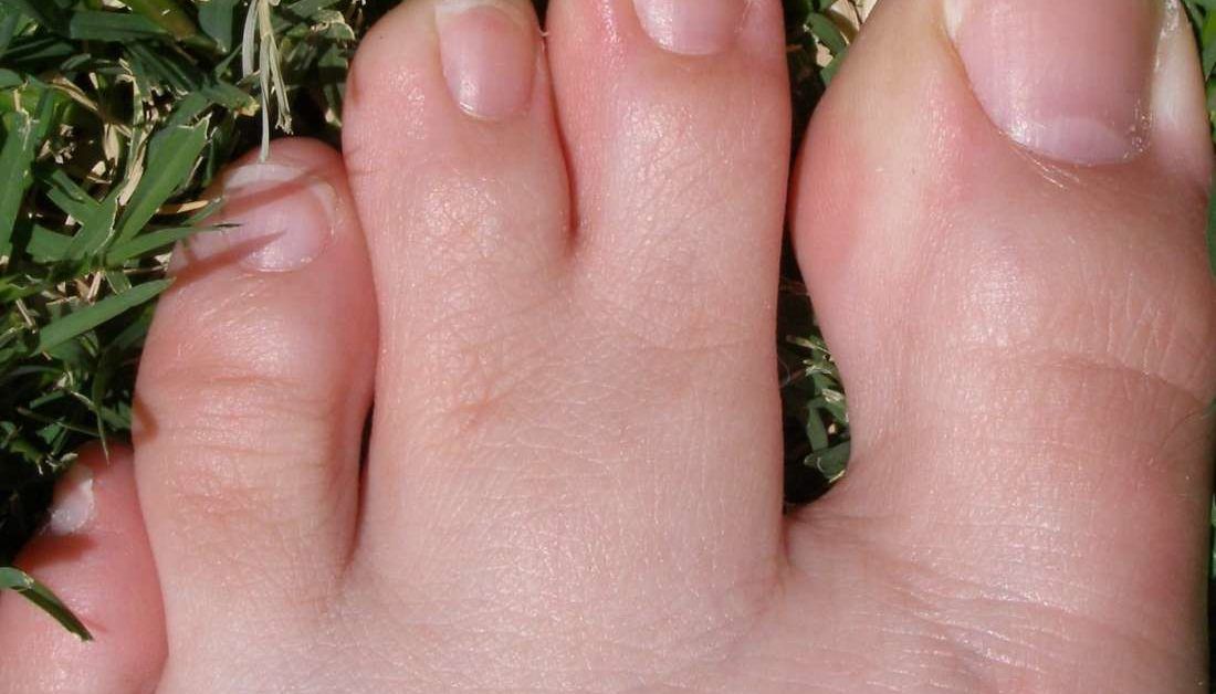 When Do Feet Stop Growing? Timeline for Men and Women