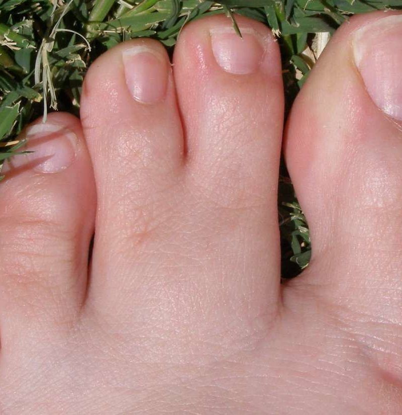 People Are Just Now Learning The Purpose Of The Pinky Toe
