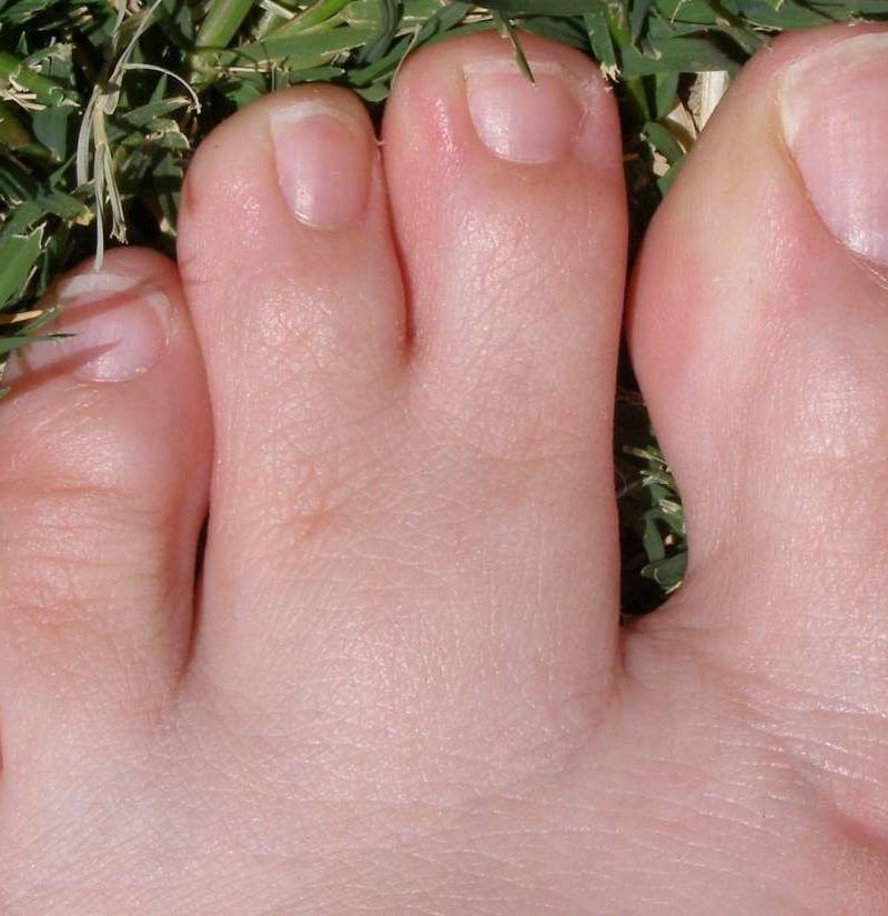 What Does It Mean When Your Second Toe Is Longer Than Your Big Toe