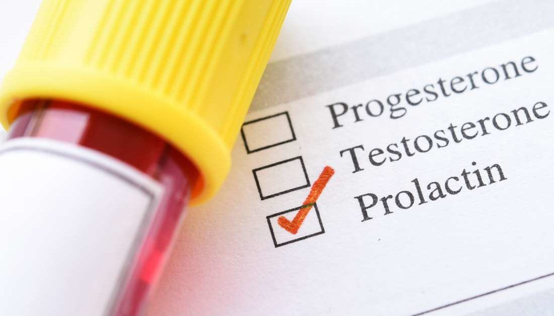 Prolactin levels Test ranges results and treatment