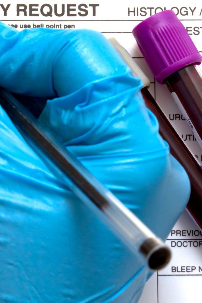 Differential blood test Uses, procedure, and results