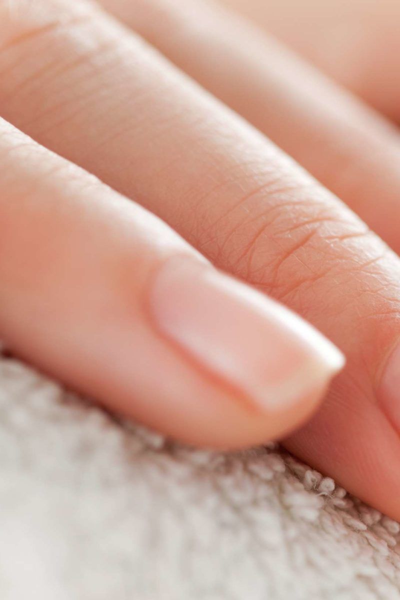 Skin Concerns] How do I fix the dry/cracked/peeling skin around my nails? :  r/SkincareAddiction