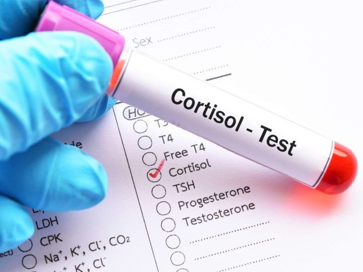 Examen d'urine - détection du syndrome de cushing par analyse d'urine sur  24H
