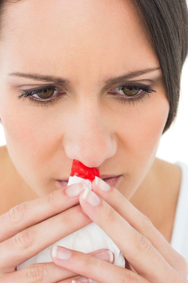 Nosebleeds at night Causes and home remedies