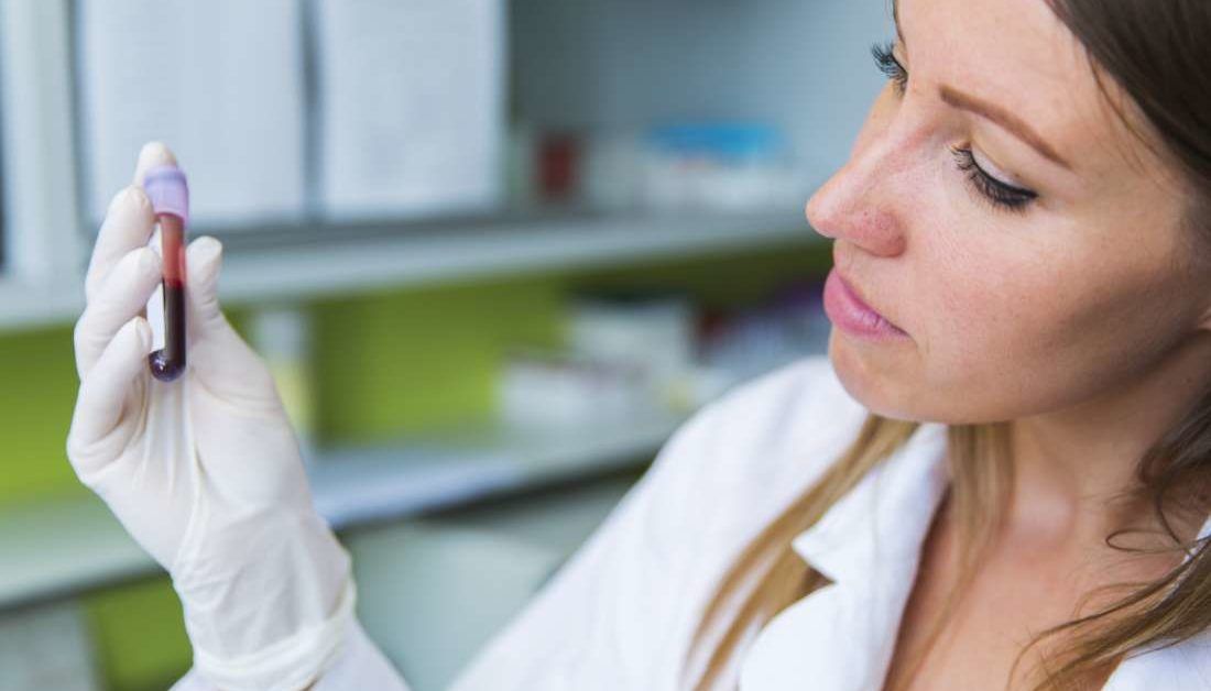 Blood gas test Procedure and normal values