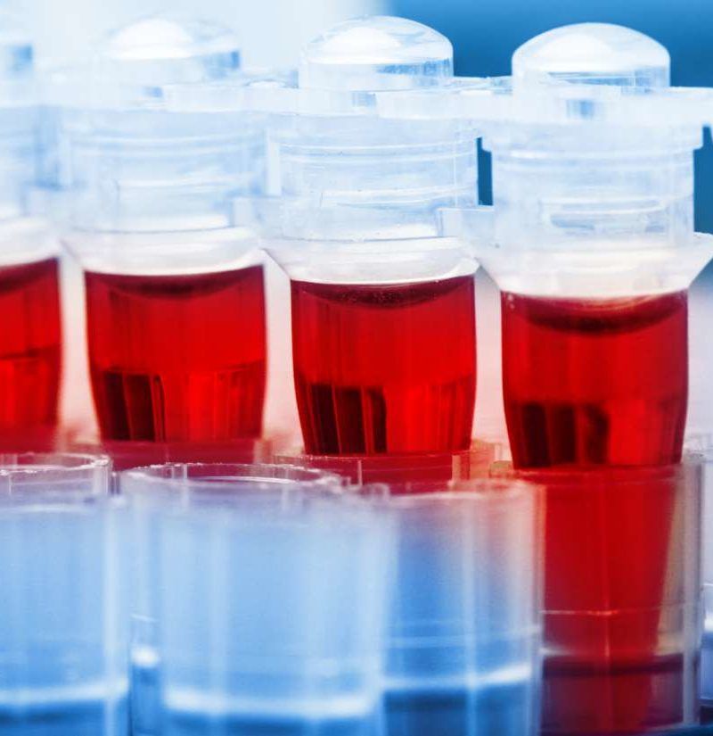 Serum albumin test Why is it done and what do the results mean?