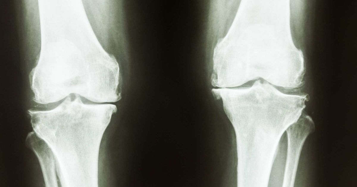 Leg Bones X-Ray MF Leggings - Limited