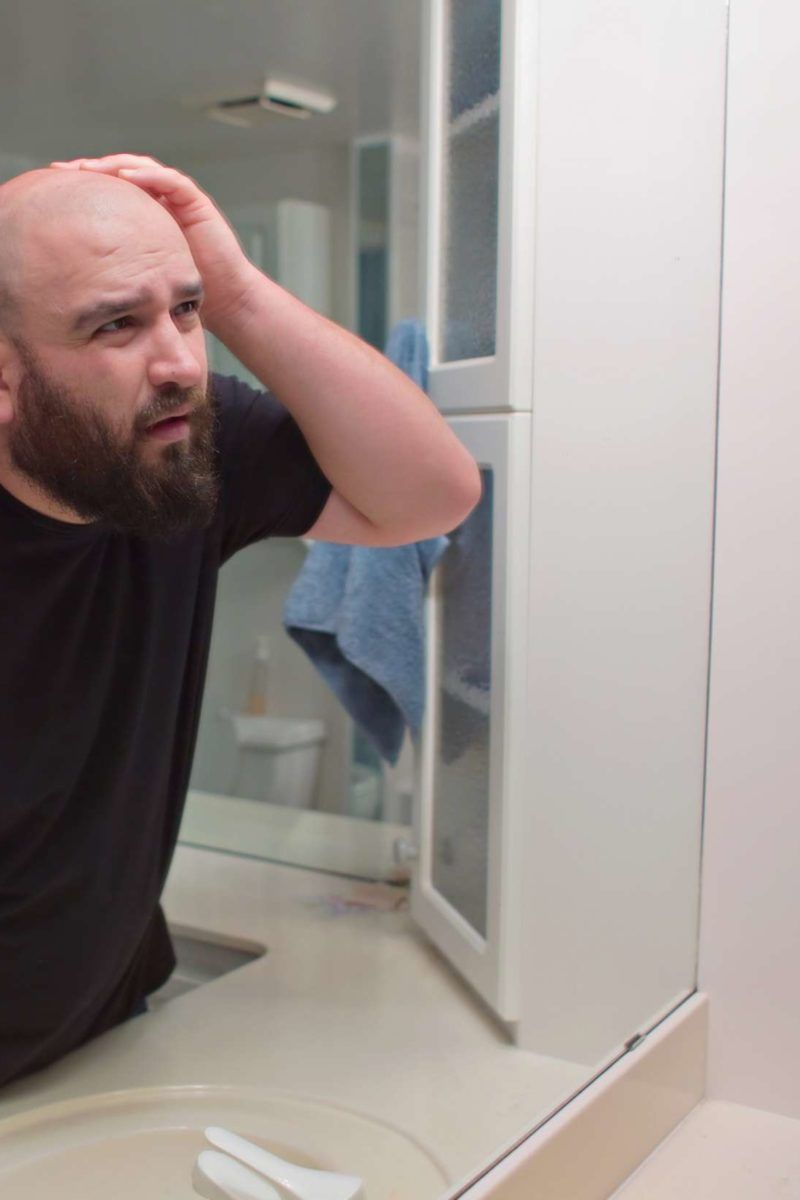 Metformin and hair loss Research, risks, and remedies