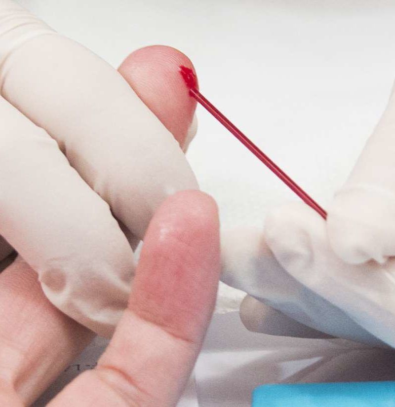 HIV seroconversion What it means, symptoms, and timing