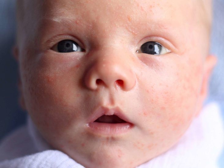 Yellow eyes on 5 day old? : r/newborns