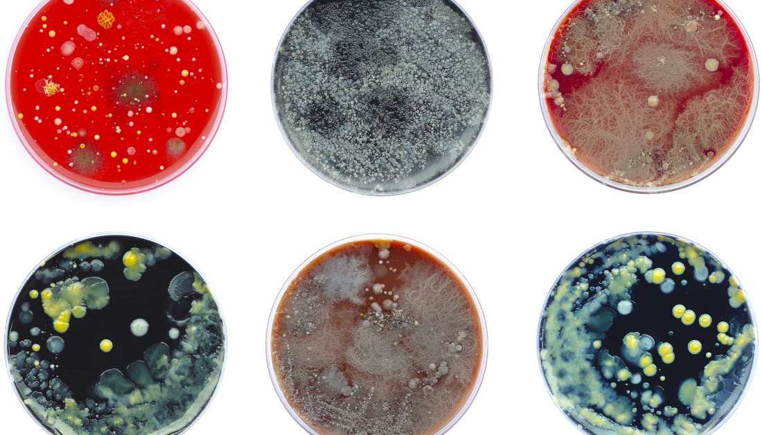 C Depth Infection Common pain relievers may worsen C. difficile infection