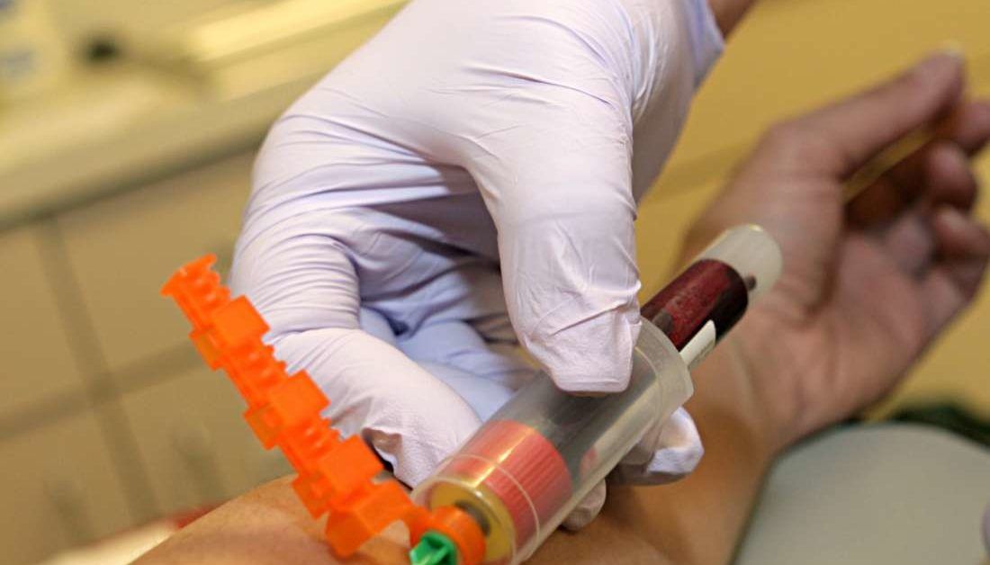 Amylase blood test What to expect and what do the results mean?